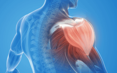 Why Shoulder Pain Is So Common